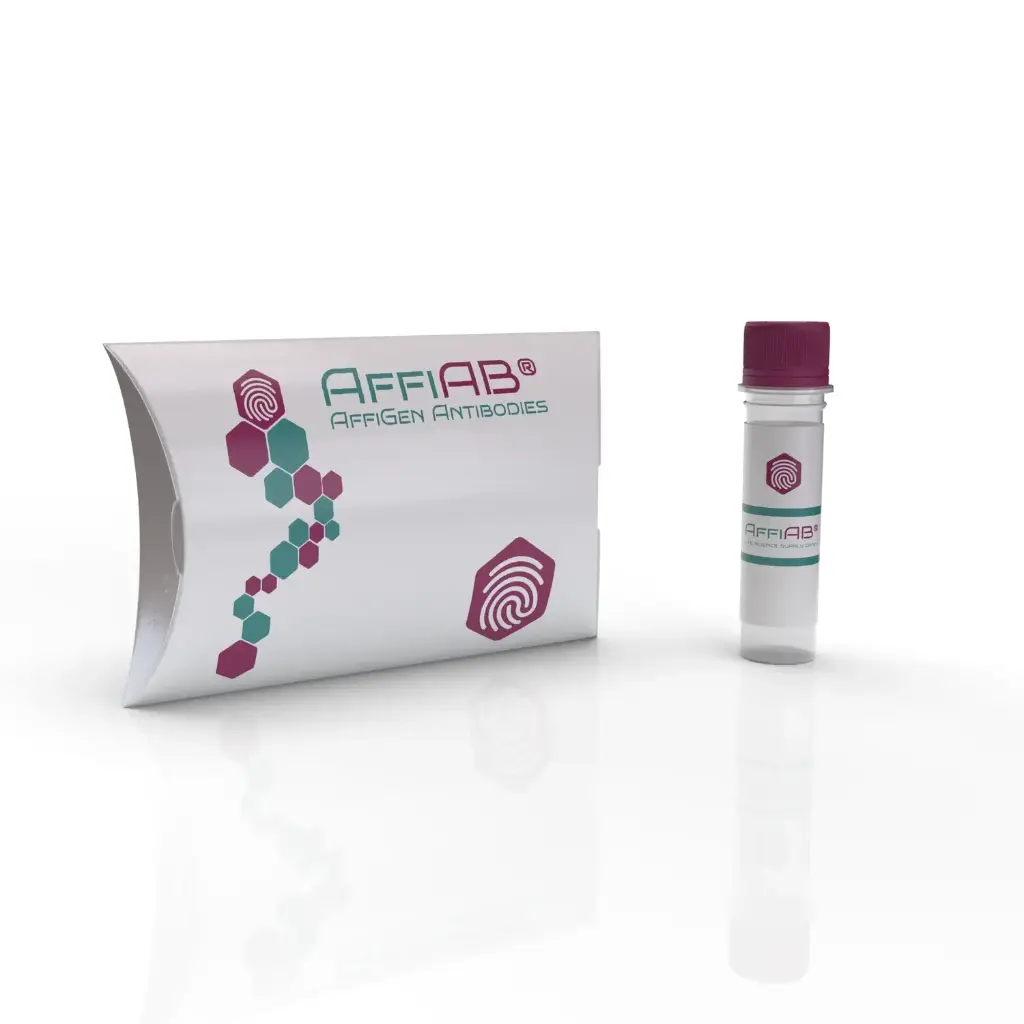 TWIST1 antibody